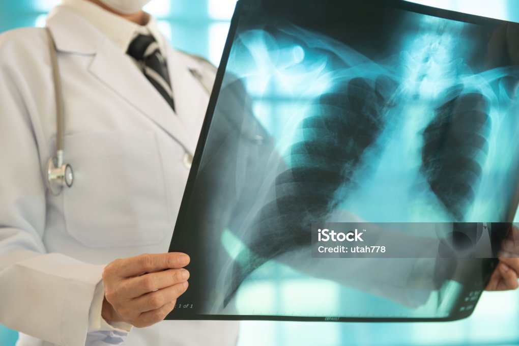 istockphoto-1472917690-2048x2048