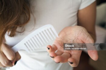 Woman losing hair on hairbrush in hand