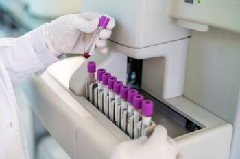 Close-up of a doctor hand looking at blood sample test tube in a machine. Cropped shot of unrecognizable scientist hands wearing protective gloves working in a testing laboratory.