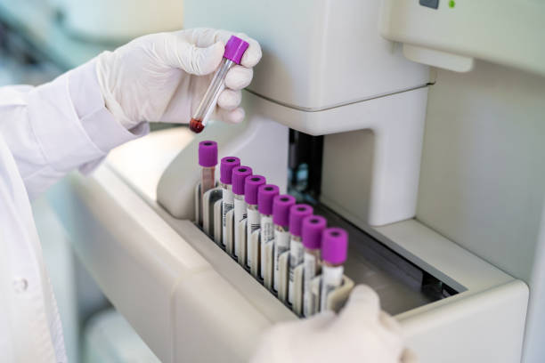 Close-up of a doctor hand looking at blood sample test tube in a machine. Cropped shot of unrecognizable scientist hands wearing protective gloves working in a testing laboratory.