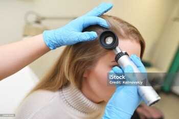 A dermatologist trichologist examines the hair structure of a young woman's patient using an optical dermatoscope device.