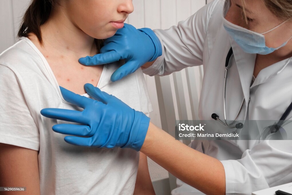 Doctor Checking Skin of Sick Girl. Kid with Red Rash being Examined at the Physician. Allergic Rash, Chicken pox, Monkeypox Symptoms on the Body of Child. Health Problem. Bacterial Infections, Disease. Small Child with Red Rash. Baby with Red Spots Blisters on the skin. Close up of Painful Rash. Health Problem. Rubella, Chickenpox, Scarlet fever, Measles. Bacterial Infections, Disease.