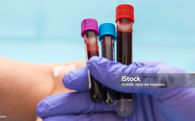 Минздрав: ежегодно 80 тысяч пациентов получают донорскую кровь