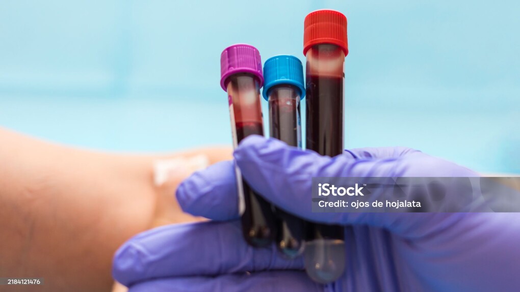 istockphoto-2184121476-2048x2048