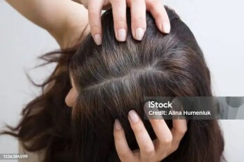 c4ede10e-1bb6-4b9c-9dd8-71d8d2ac3290