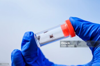 hand in gloves holding small dangerous insects ticks caught in a test tube for research in the laboratory to detect the disease