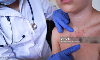 The boy's skin condition suggests an allergic reaction.