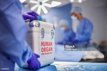 organ transplant surgery