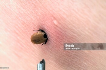 istockphoto-157646285-2048x2048