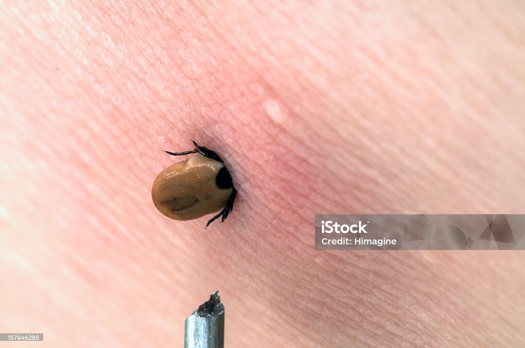 istockphoto-157646285-2048x2048
