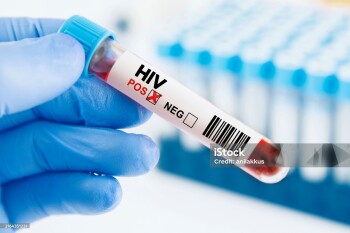 Human immunodeficiency virus blood test in hand