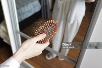 Hair Loss on Comb After Brushing, Hand Holding Fallen Hair at Home