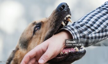 One German shepherd bites a man by the hand. Training and breeding thoroughbred dogs.