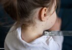БҚО-да қызылша бойынша эпидемиологиялық жағдай күрделі