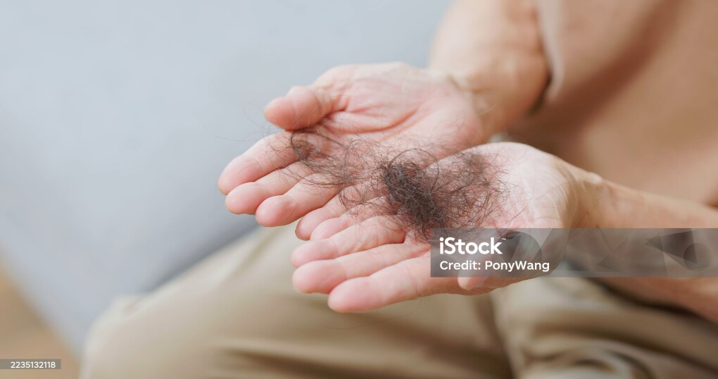 Close-Up A balding Asian man sits in his living room carefully looking at his loss hair in hand