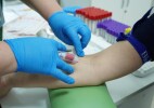 Батыс Қазақстанда 2 100-ден астам әйел сүт безі обырымен есепте тұр